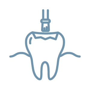 Sealant on tooth general dentistry service