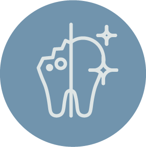 Dental bonding service